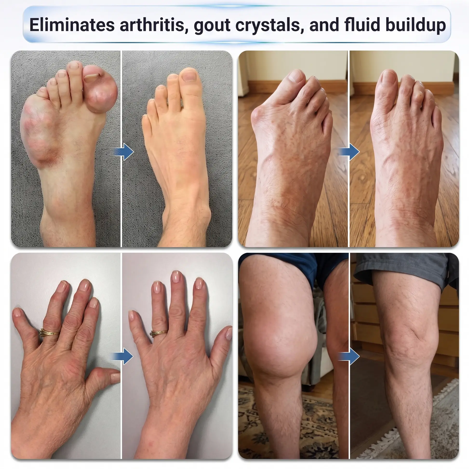 0.05mm Microneedle Fast-Acting Joint & Bone Relief Roll-On - Image 4