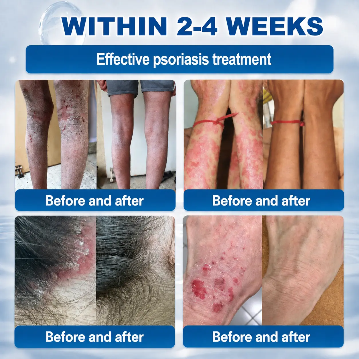 Advanced Corrective Cream - Image 4