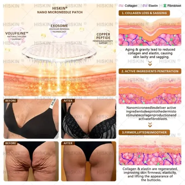 Bust Volume Lift & Firming Nano Microneedle Patch Volufiline + Exosome + Copper Peptide Formula Powered by Cellular Renewal Technology - Image 6