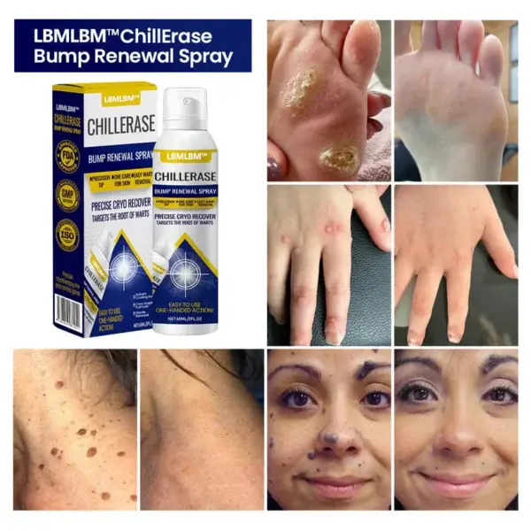 ChillErase Bump Renewal Spray - Image 5