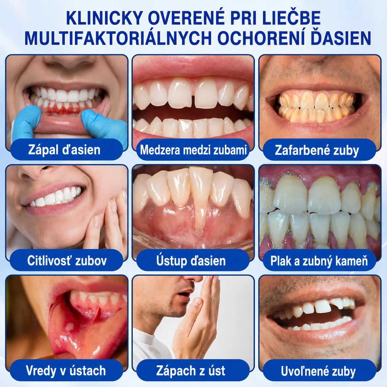 GumRevive Parodontálny opravný gél - Image 6