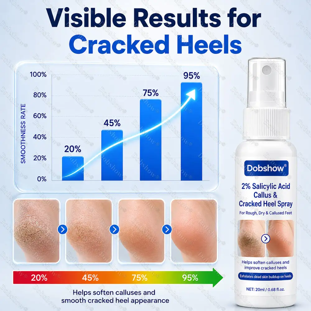 2% Salicylic Acid Callus & Cracked Heel Spray - Image 10