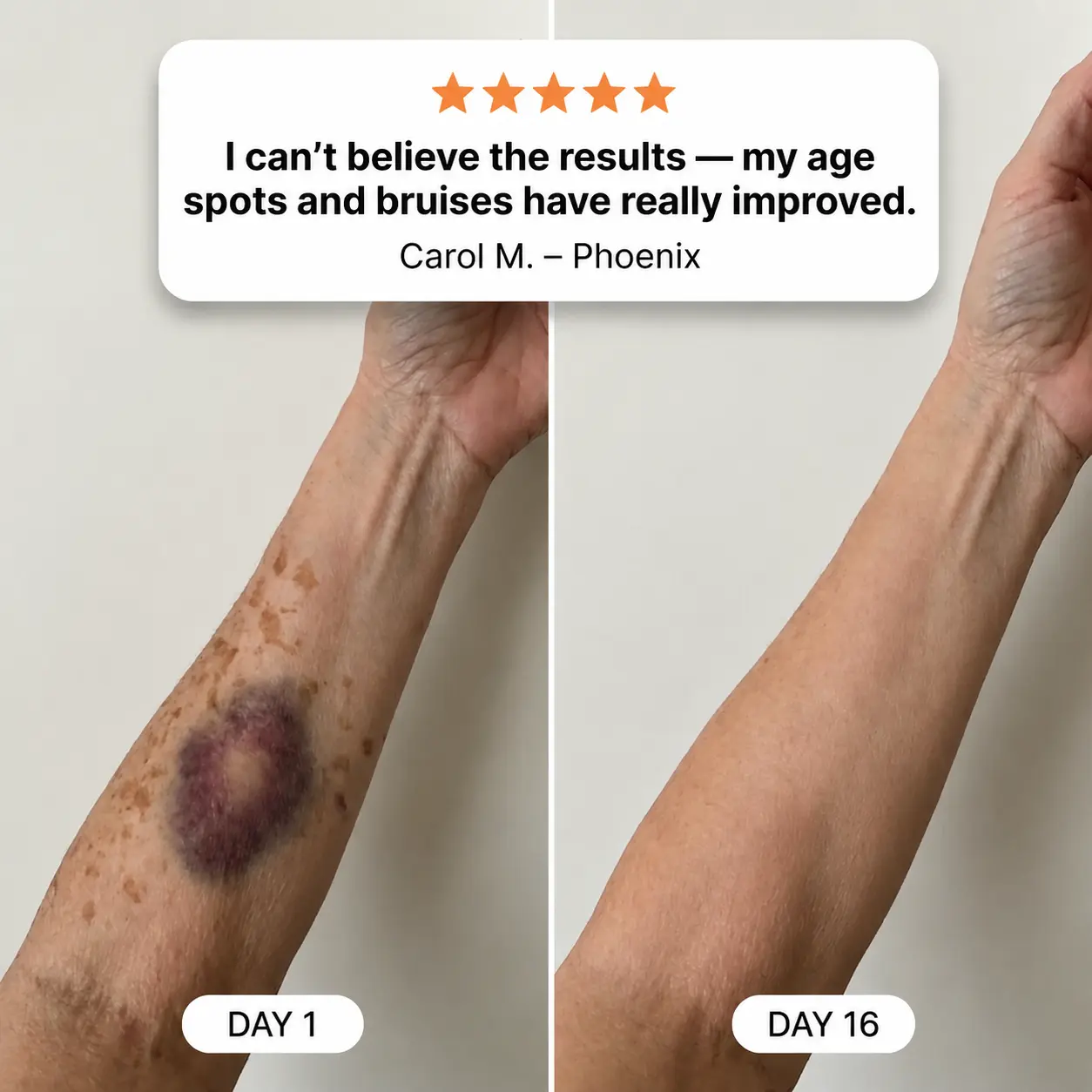 Newly Upgraded Dark Spot & Bruise Recovery Cream - Image 2