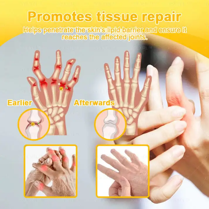 💞💞 Bee Venom Pain-Relief Bone Healing Cream - Image 12