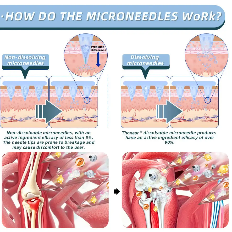 Nano-microneedle joint patch - Image 5