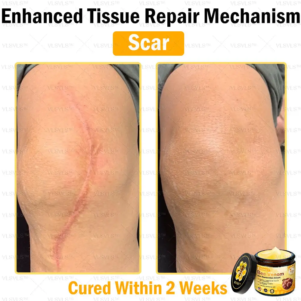 Bee Venom Skin Restoration Cream - Image 7